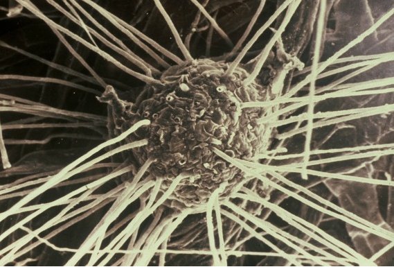 Mycorrhizal fungi