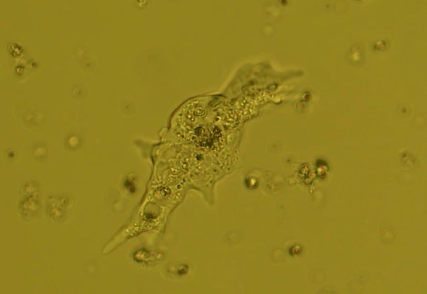 Testate amoeba